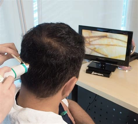 Hair Transplant Clinic in The Philippines .